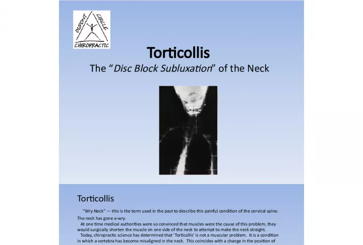Understanding Torticollis: Disc Block Subluxation of the Neck